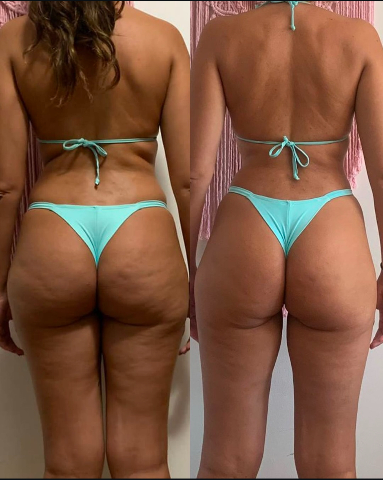 Transformação - Antes e Depois