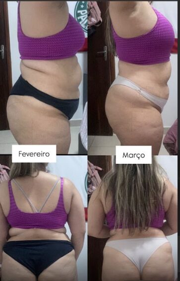Transformação - Antes e Depois